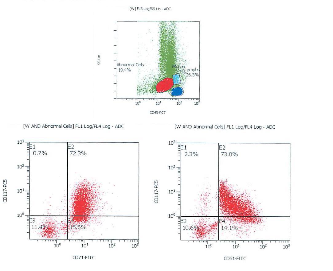 Flow cytometry of peripheral blood; abnormal cell population gated red; expression of CD117, CD71, and CD61